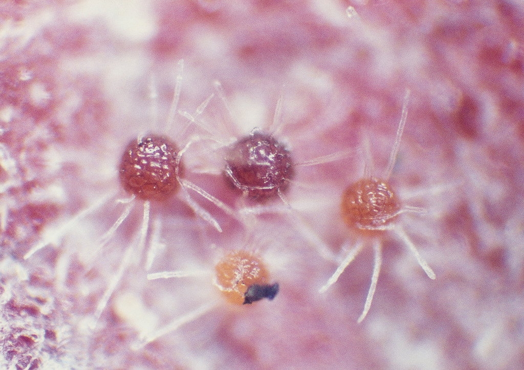 Kazmatéciumok mikroszkópikus képe